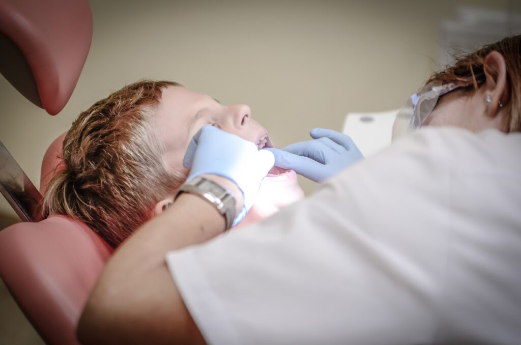 dental sealants application in a child