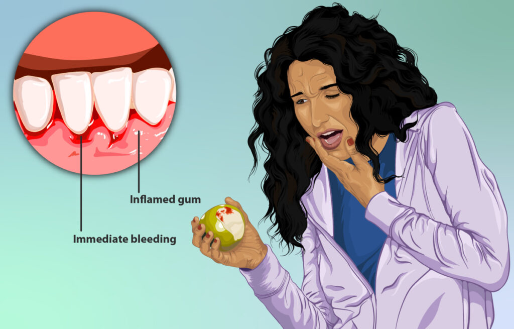 why-do-my-gums-bleed-when-i-brush-my-teeth-express-dentist