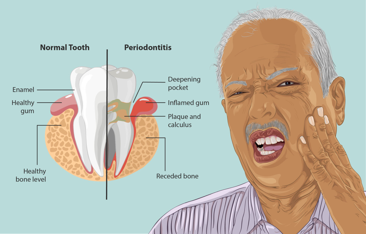 How to Slow Down Bone Loss in Teeth? Express Dentist